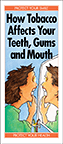 How Tobacco Affects Your Teeth, Gums and Mouth